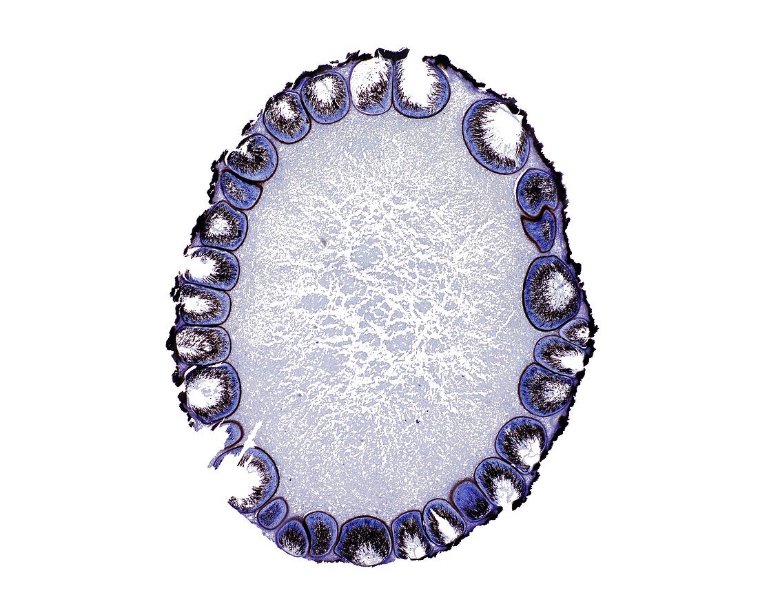 Mushroom (Hypoxylon sp),light micrograph