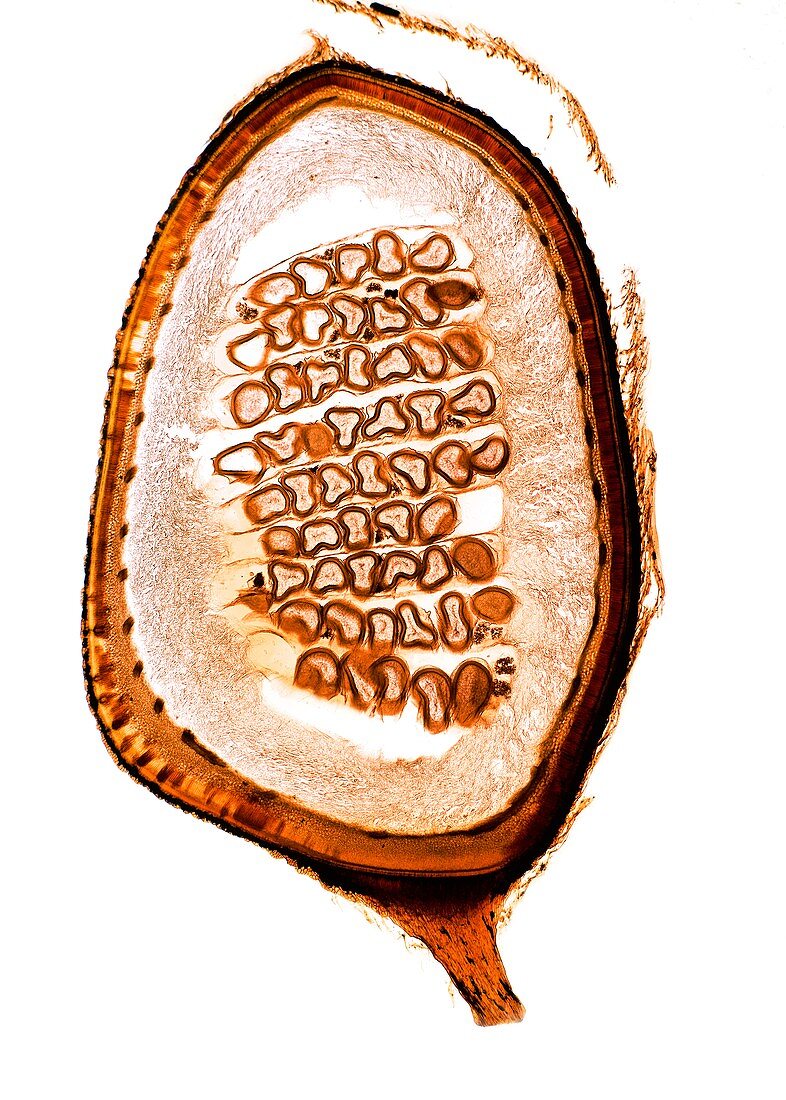 Fern (Pilularia sp.) sporocarp