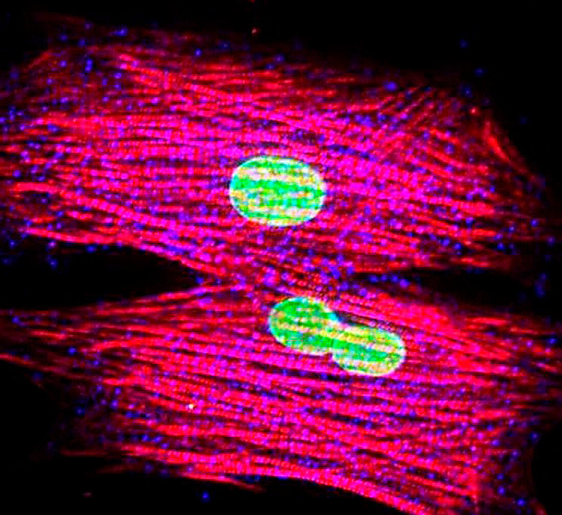 Heart muscle cells,light micrograph