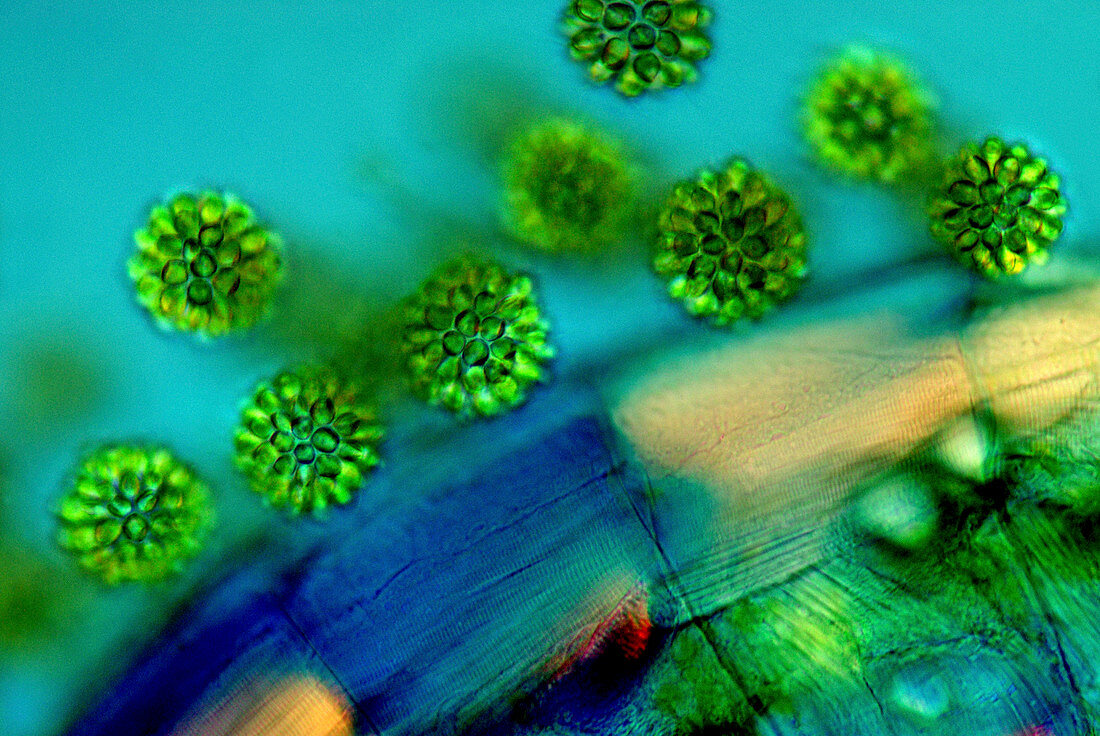 Synurid algae,light micrograph