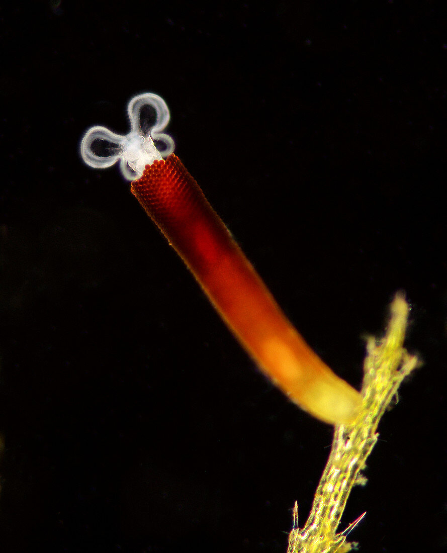 Floscularia rotifer,light micrograph