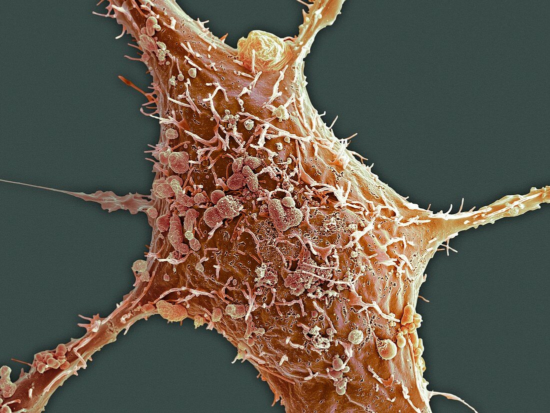 Breast cancer cell,SEM