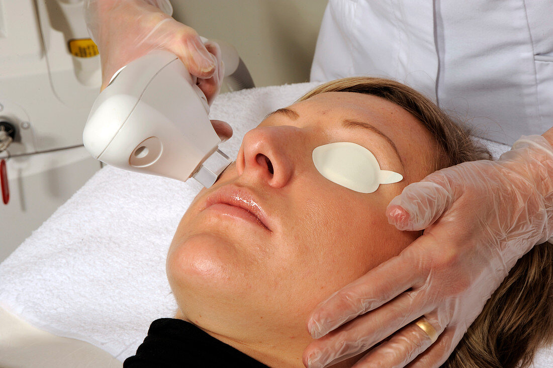 Skin laser therapy
