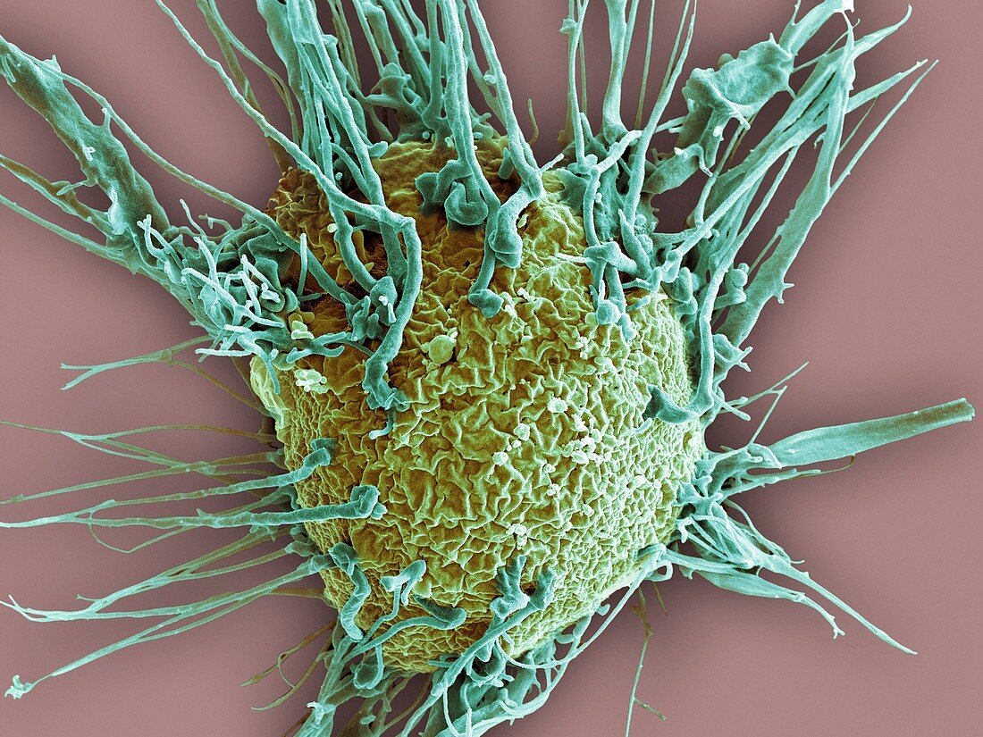 Breast cancer cell,SEM