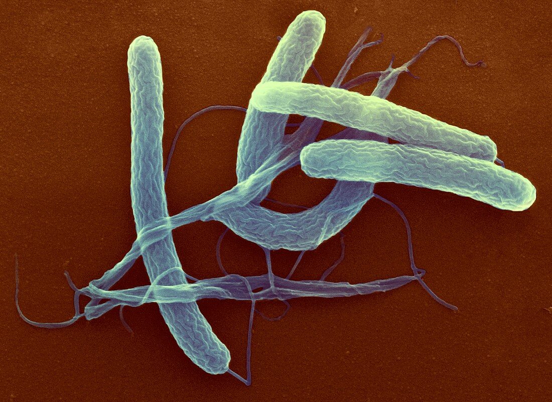 Cholera bacteria,ESEM