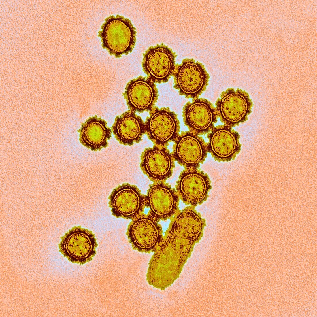 H1N1 flu virus particles,TEM