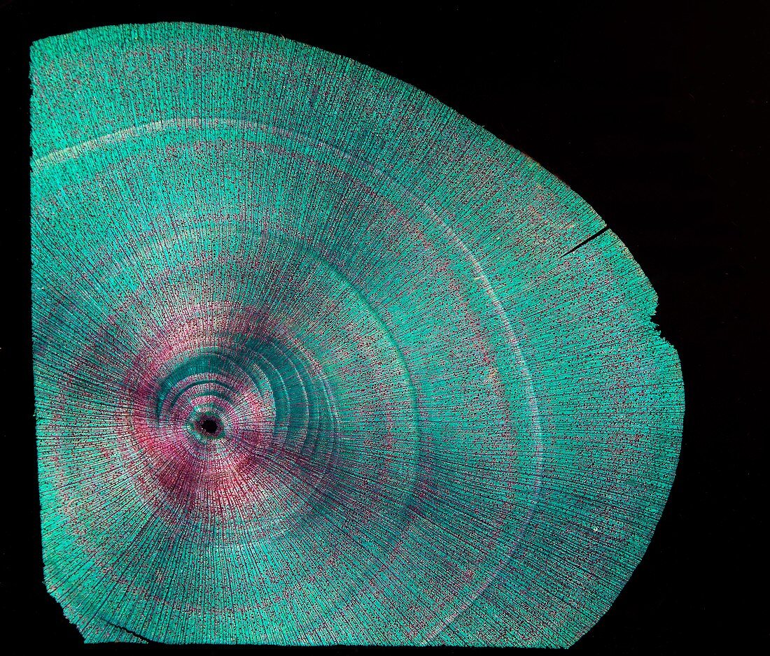 Daphnophyllum,micrograph
