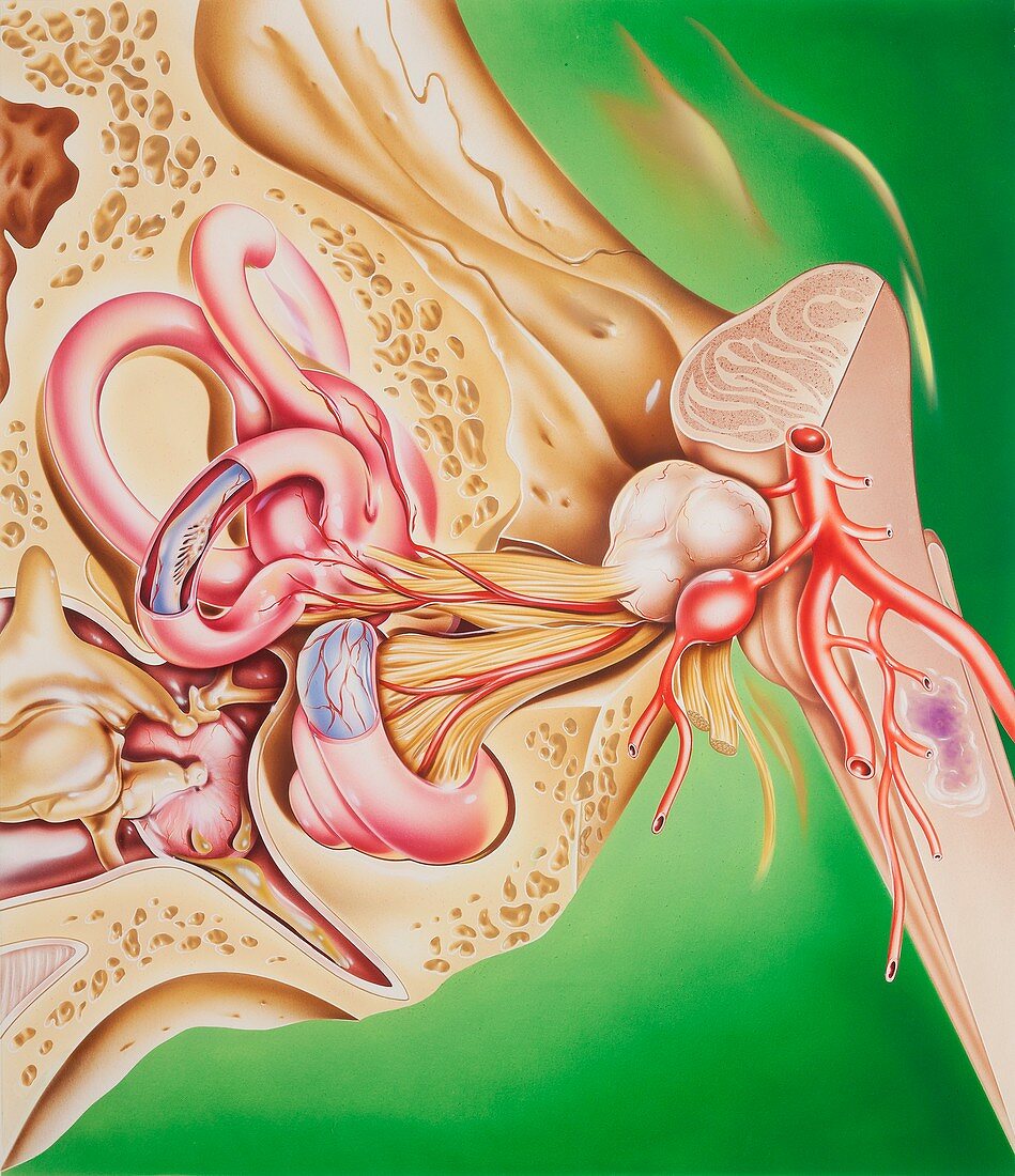 Causes of vertigo,illustration