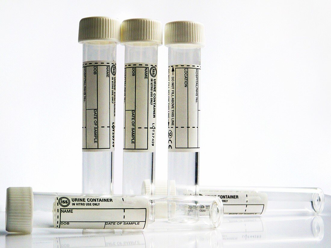 Urine sample containers