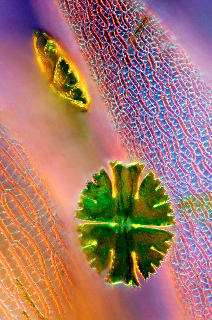 Desmids and sphagnum moss,micrograph