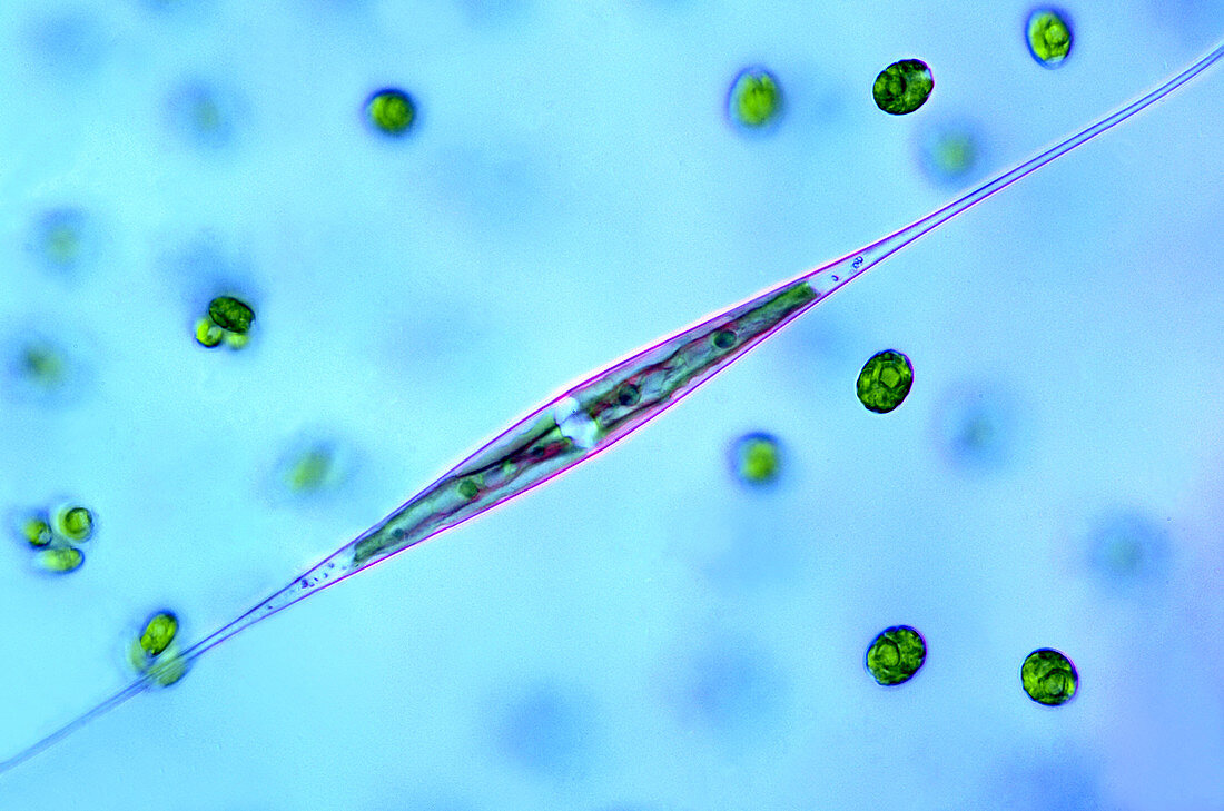 Desmid and chlorophytes,micrograph