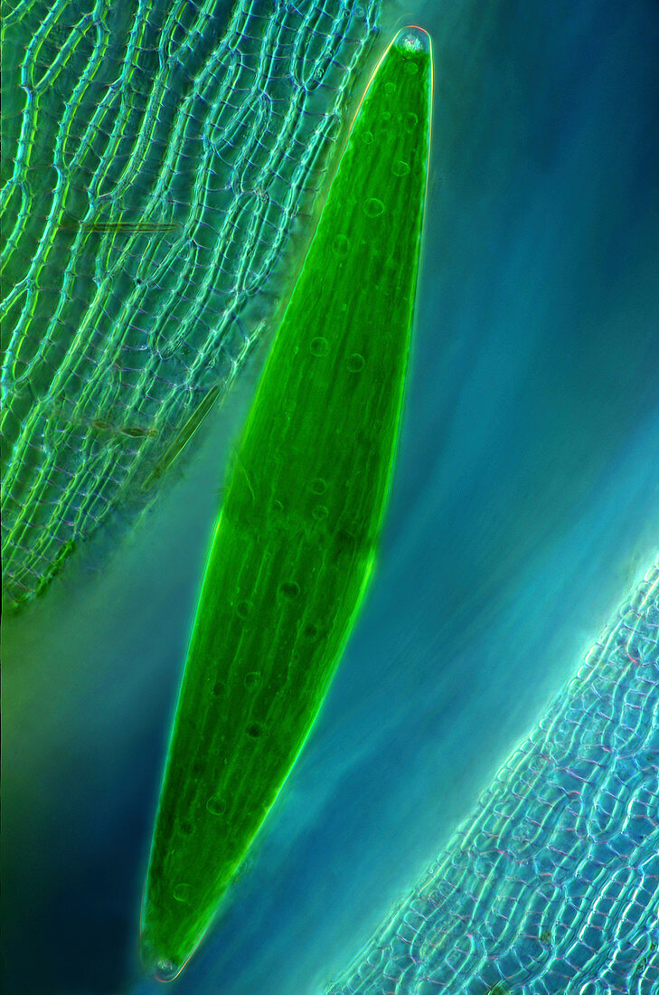 Desmid on sphagnum moss,light micrograph