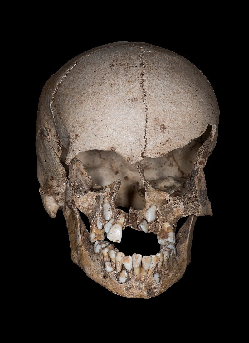 Neolithic Child's Skull