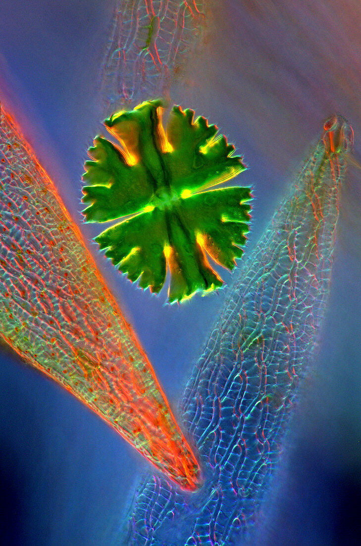 Desmid and sphagnum moss,micrograph