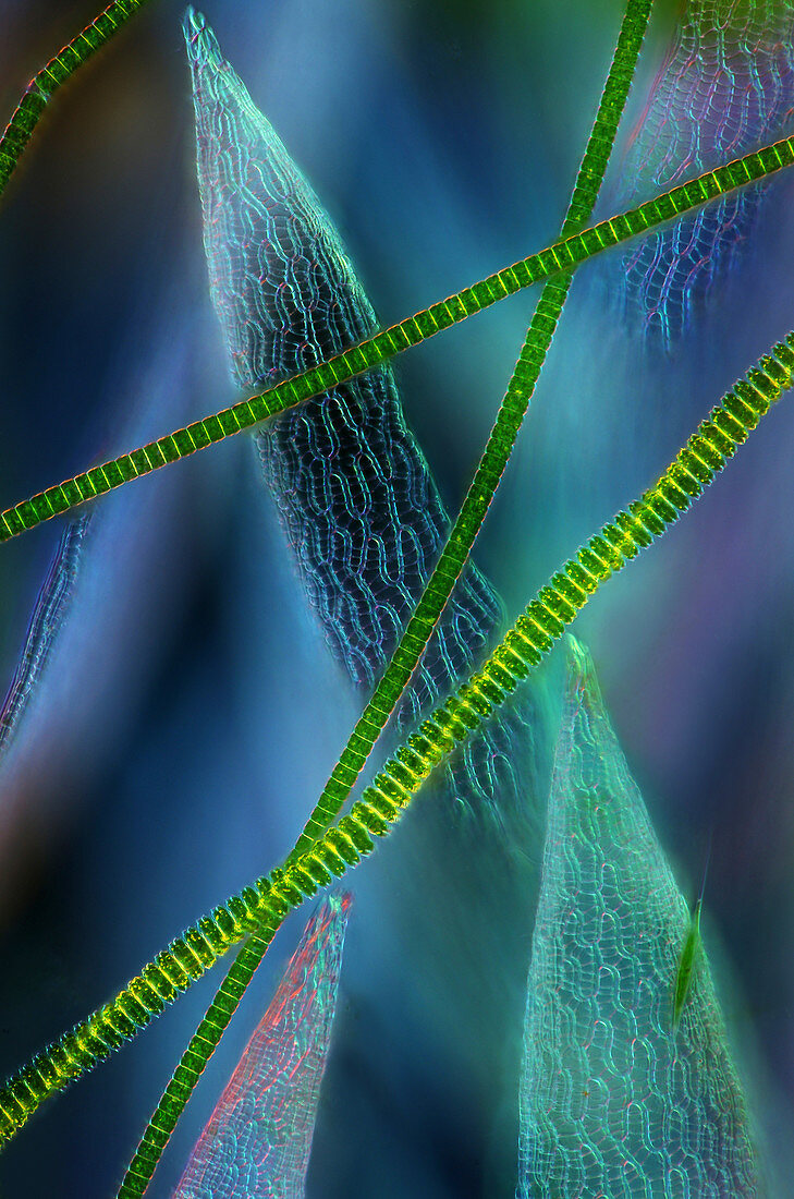 Desmids on sphagnum moss,micrograph