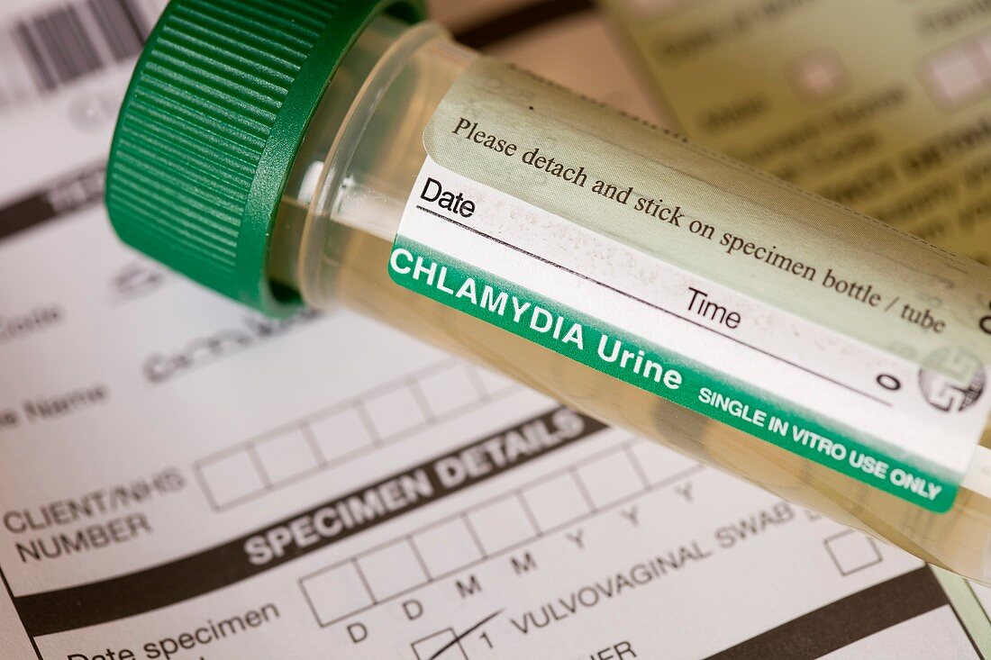 A Chlamydia self testing kit