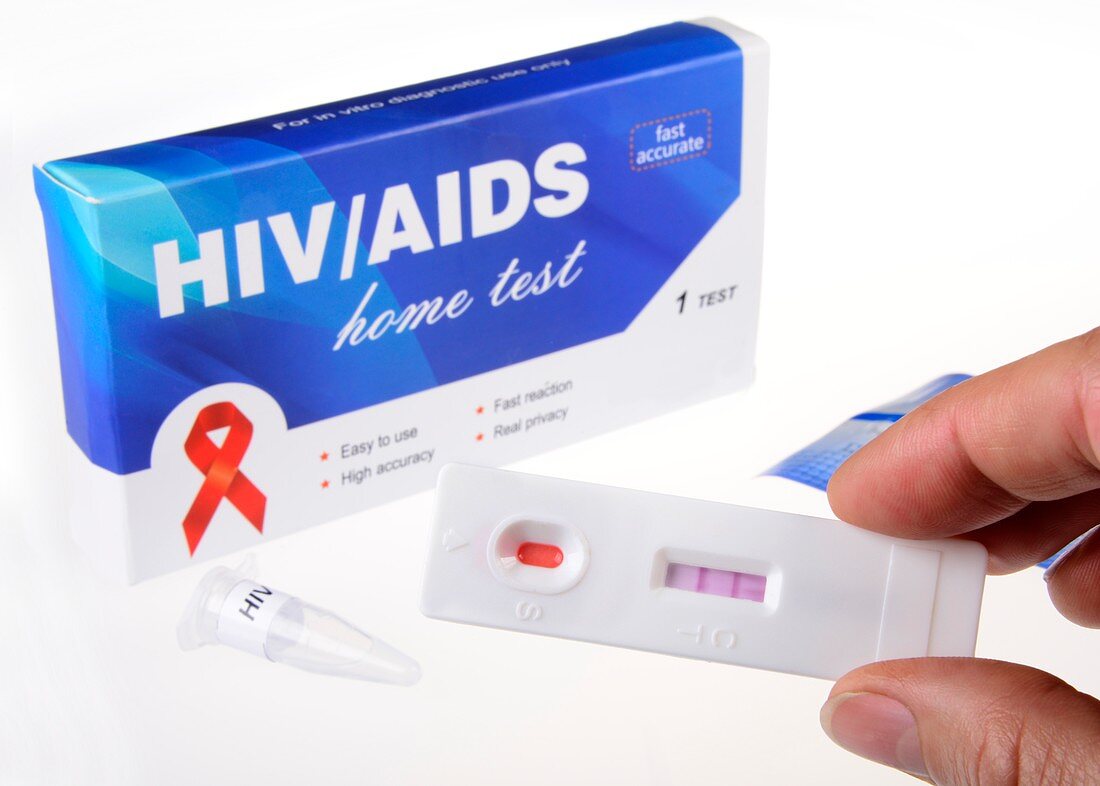 HIV home blood test,positive