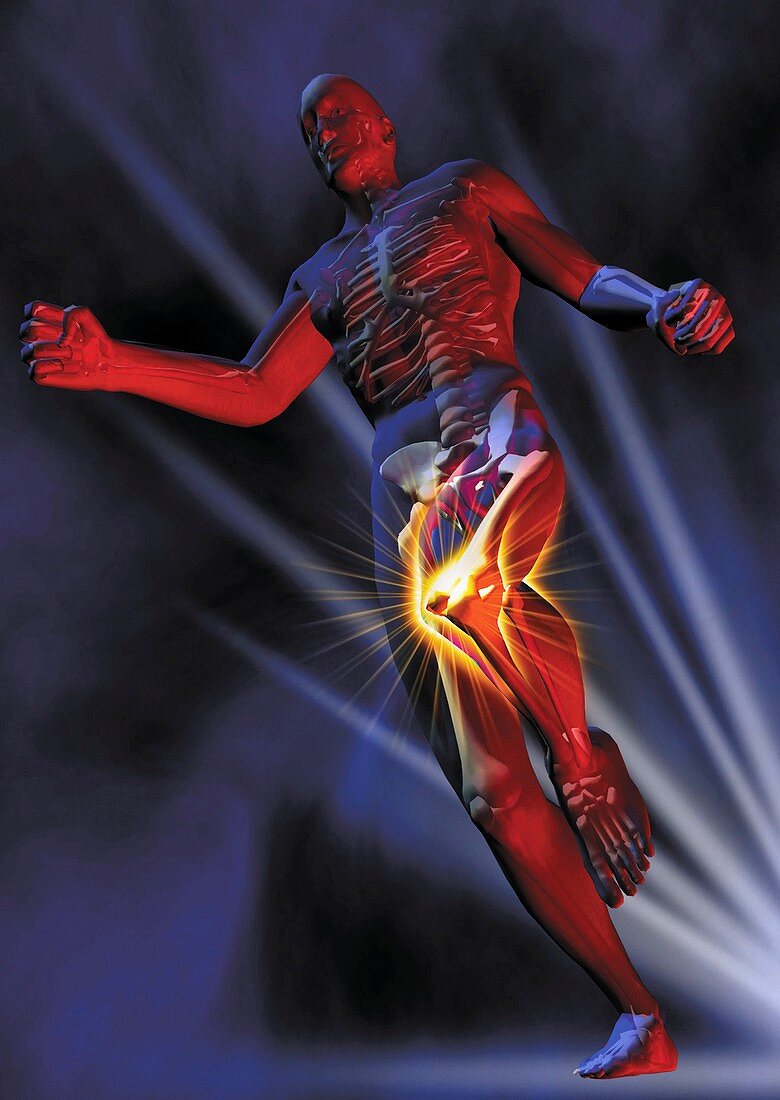 Knee pain,conceptual illustration