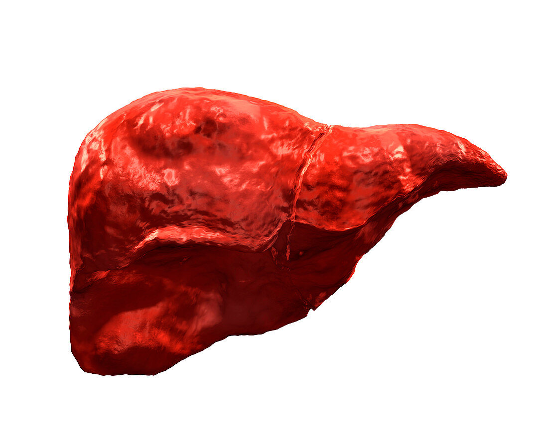 Cirrhotic liver,illustration