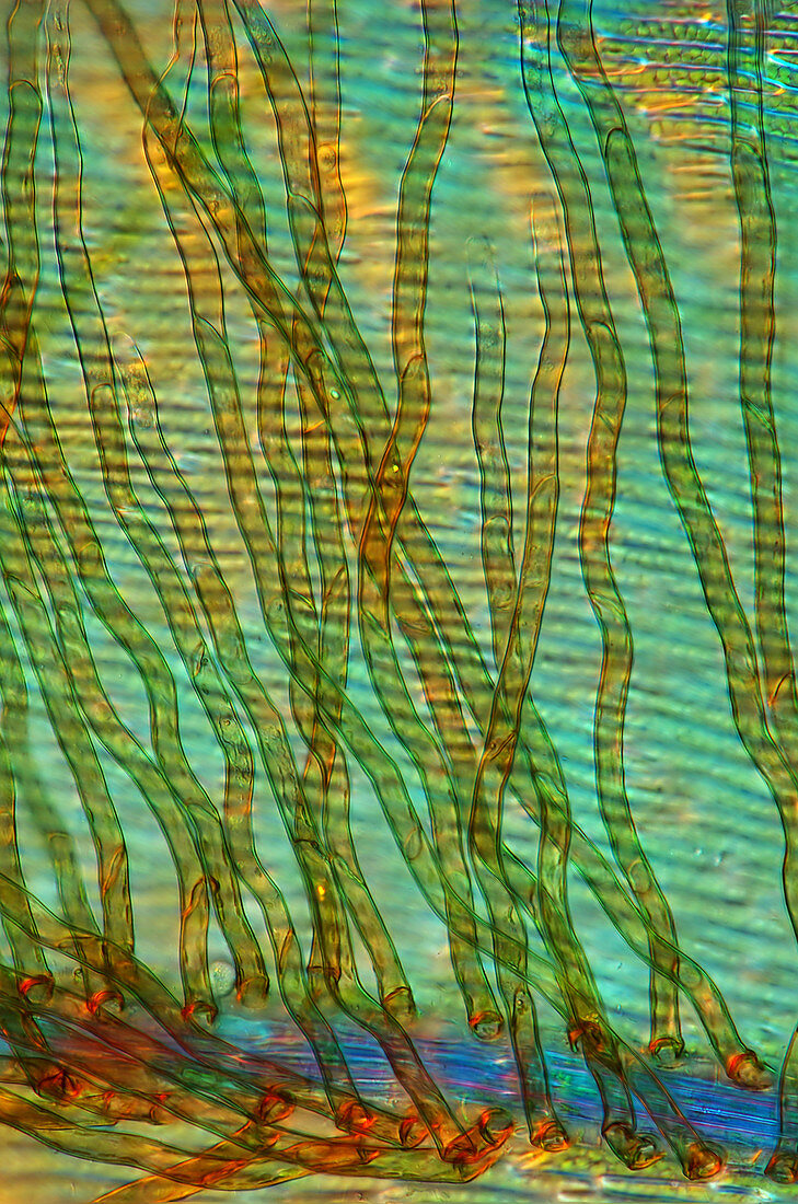 Fungi on sphagnum moss,micrograph