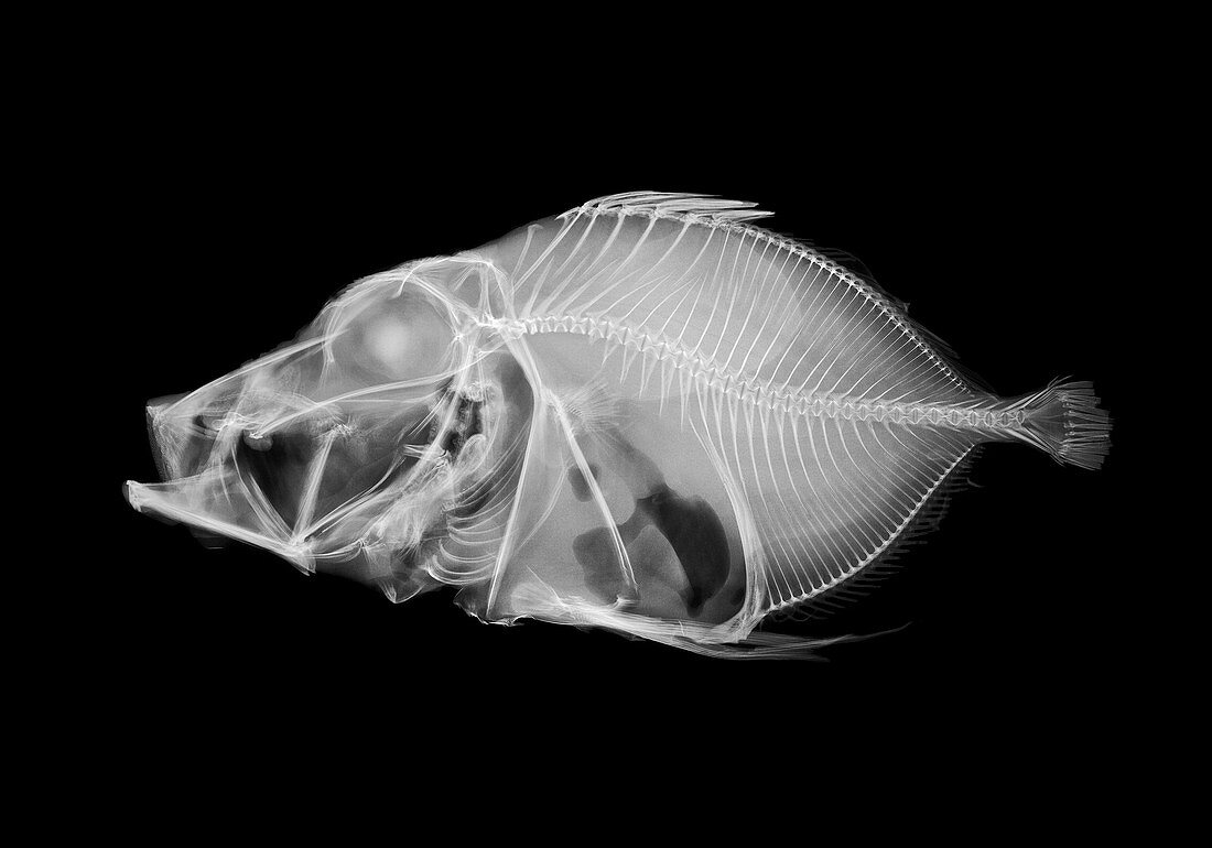 Rosy dory,X-ray