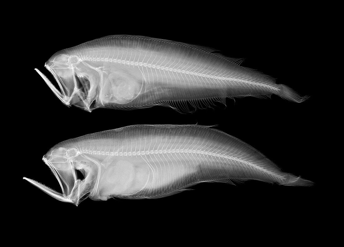 Bothid flatfish,X-ray