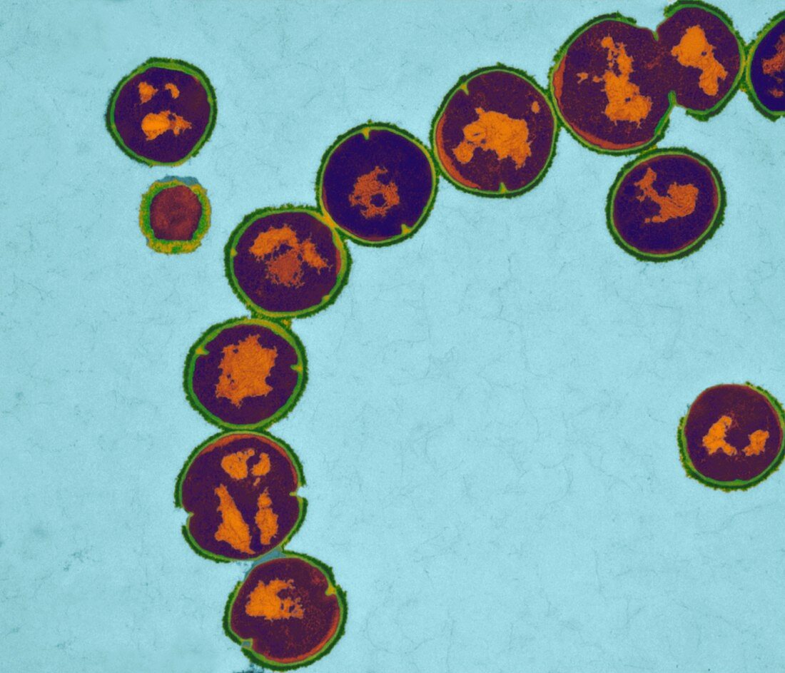Streptococcus pyogenes bacteria,TEM