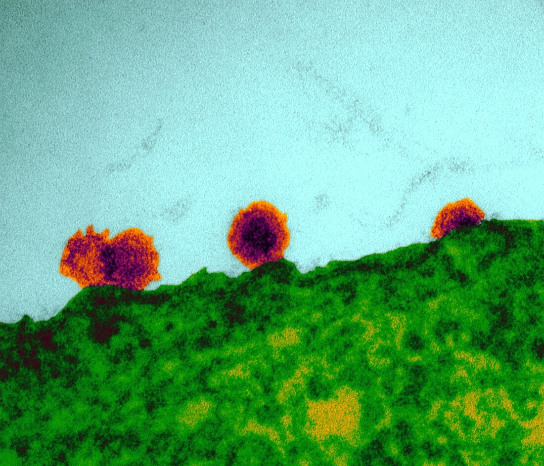 Chikungunya virus particles budding