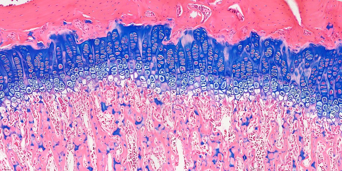 Bone growth plate,light micrograph