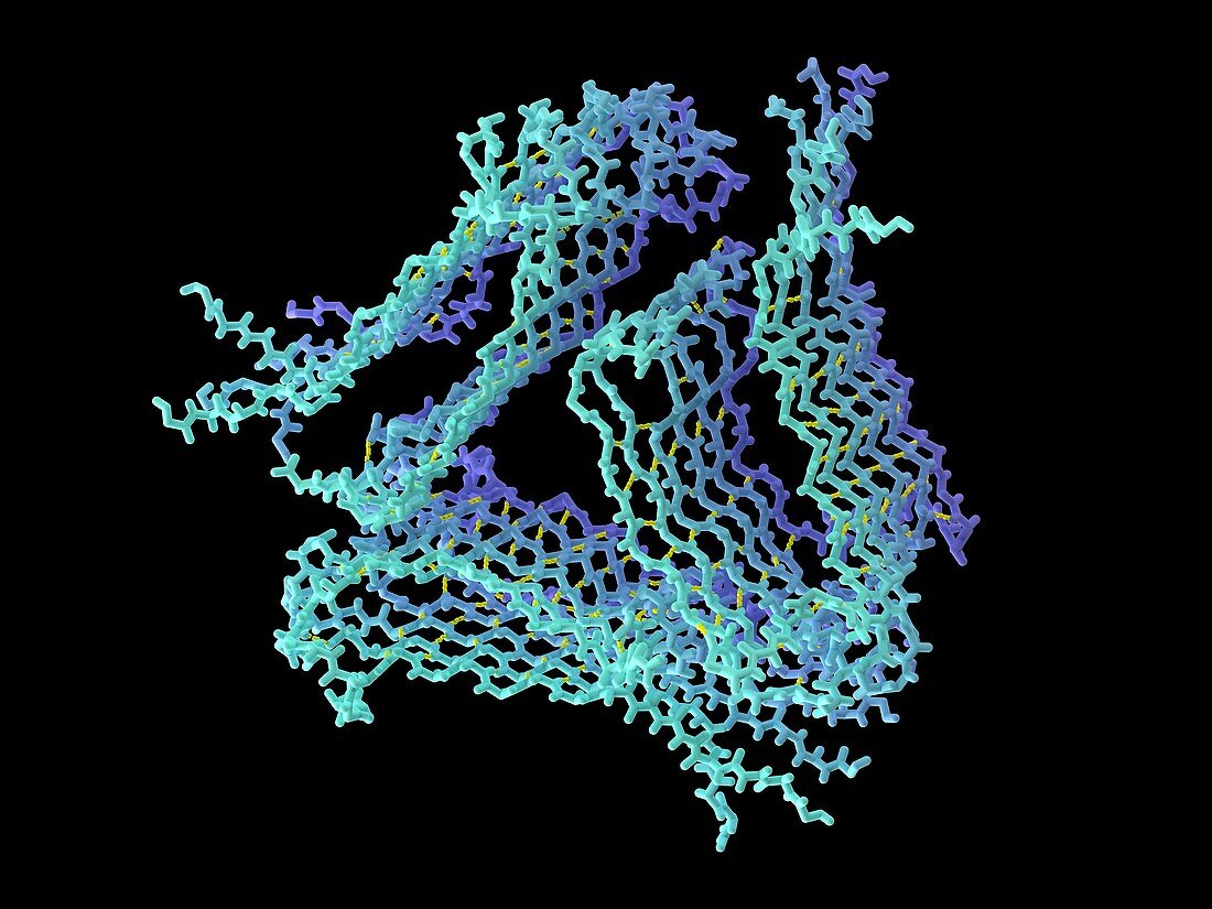 Alzheimer's beta-amyloid fibrils