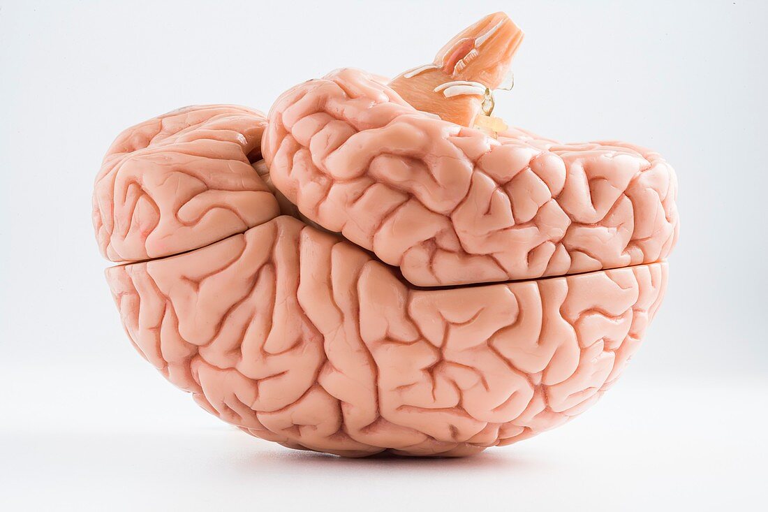 Anatomical model of the human brain