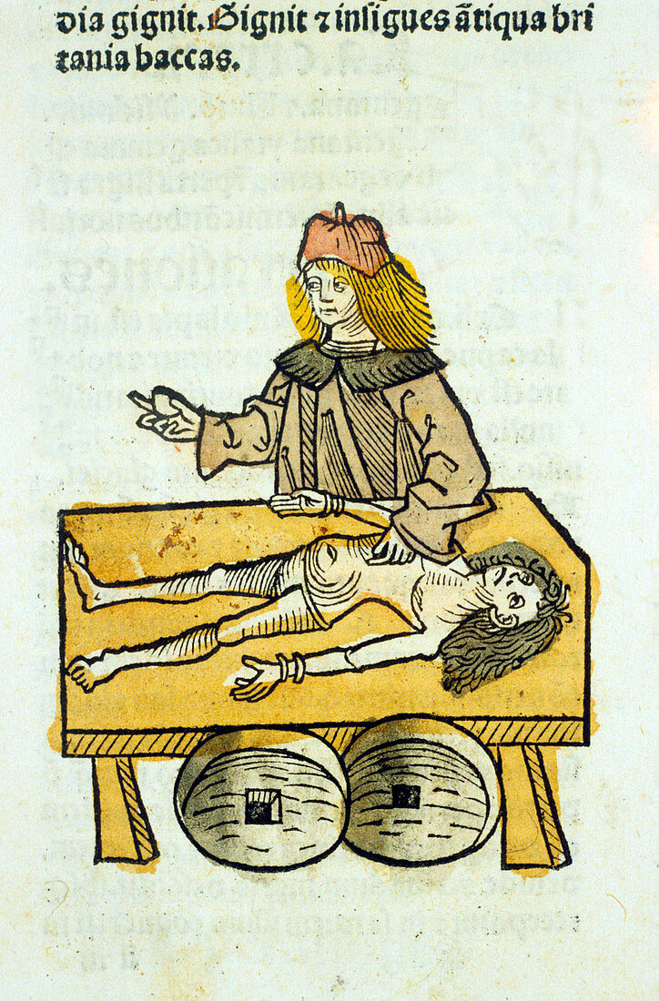 Medieval surgery,15th century