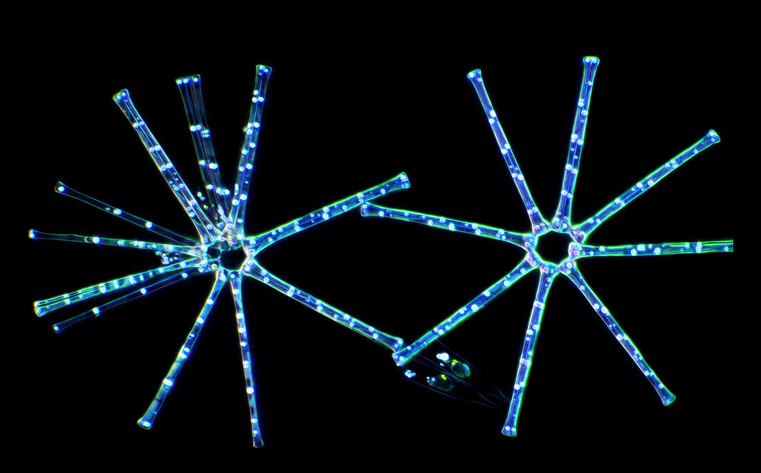 Asterionella diatoms,light micrograph
