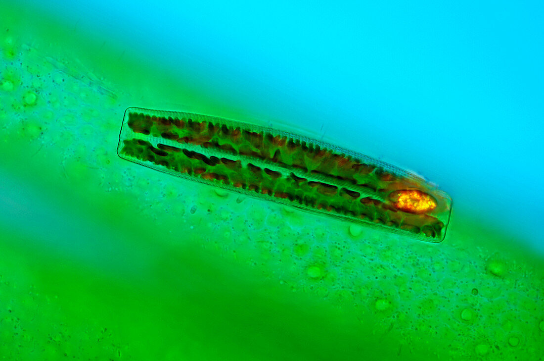 Epithemia diatom,light micrograph