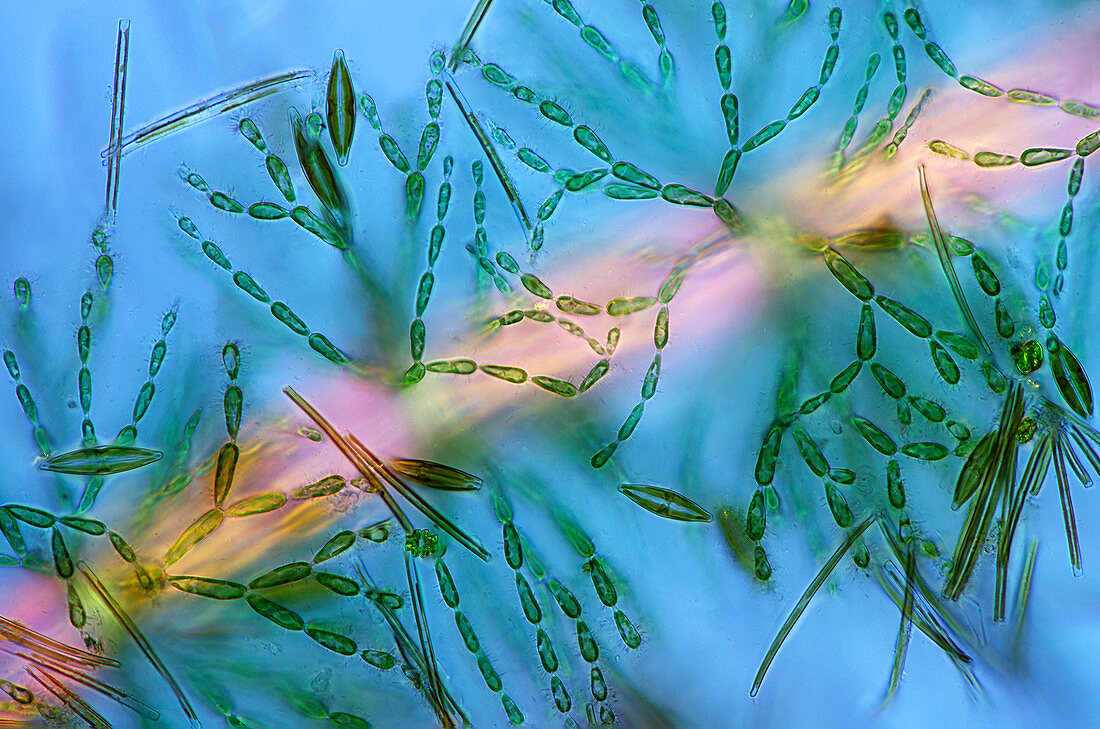 Diatoms on red algae,light micrograph