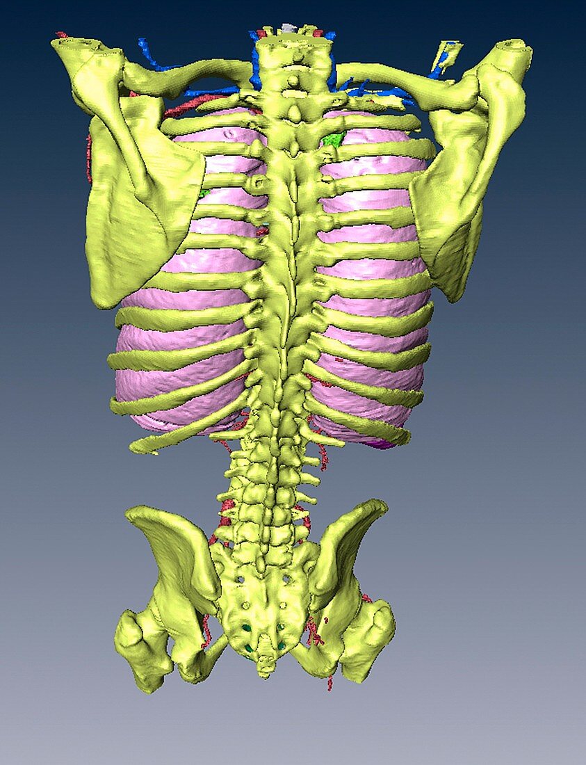 Torso skeleton and lungs,3D CT scan