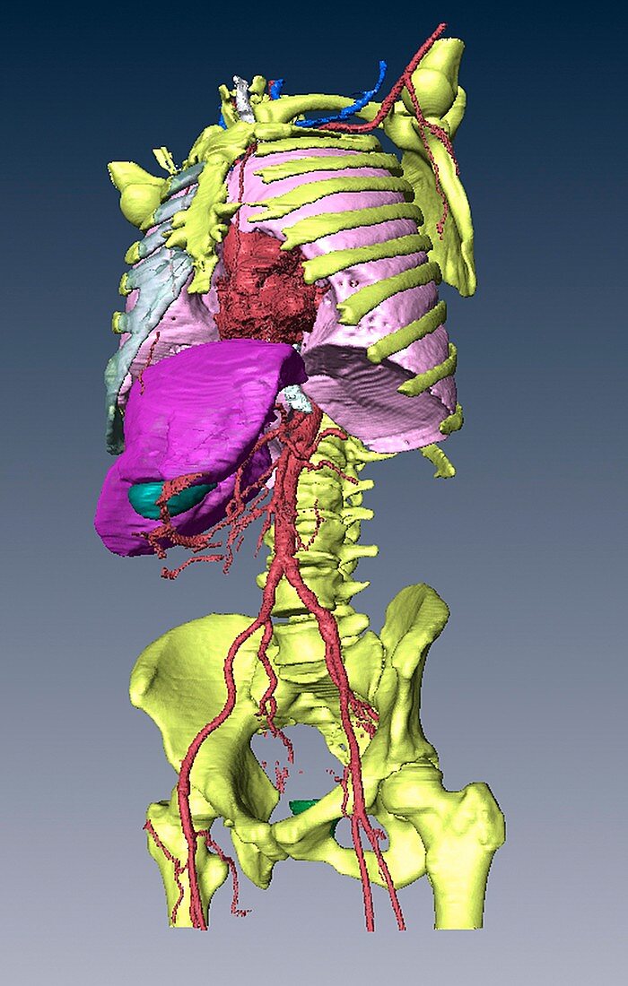 Torso skeleton and organs,3D CT scan