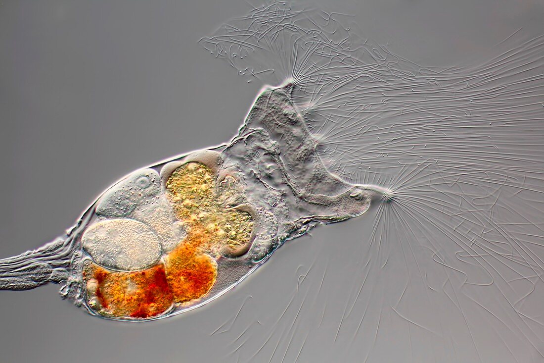 Rotifer with eggs,light micrograph