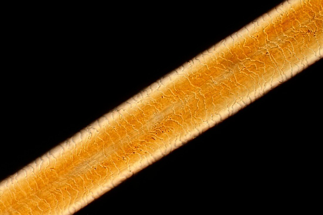 Human hair,light micrograph
