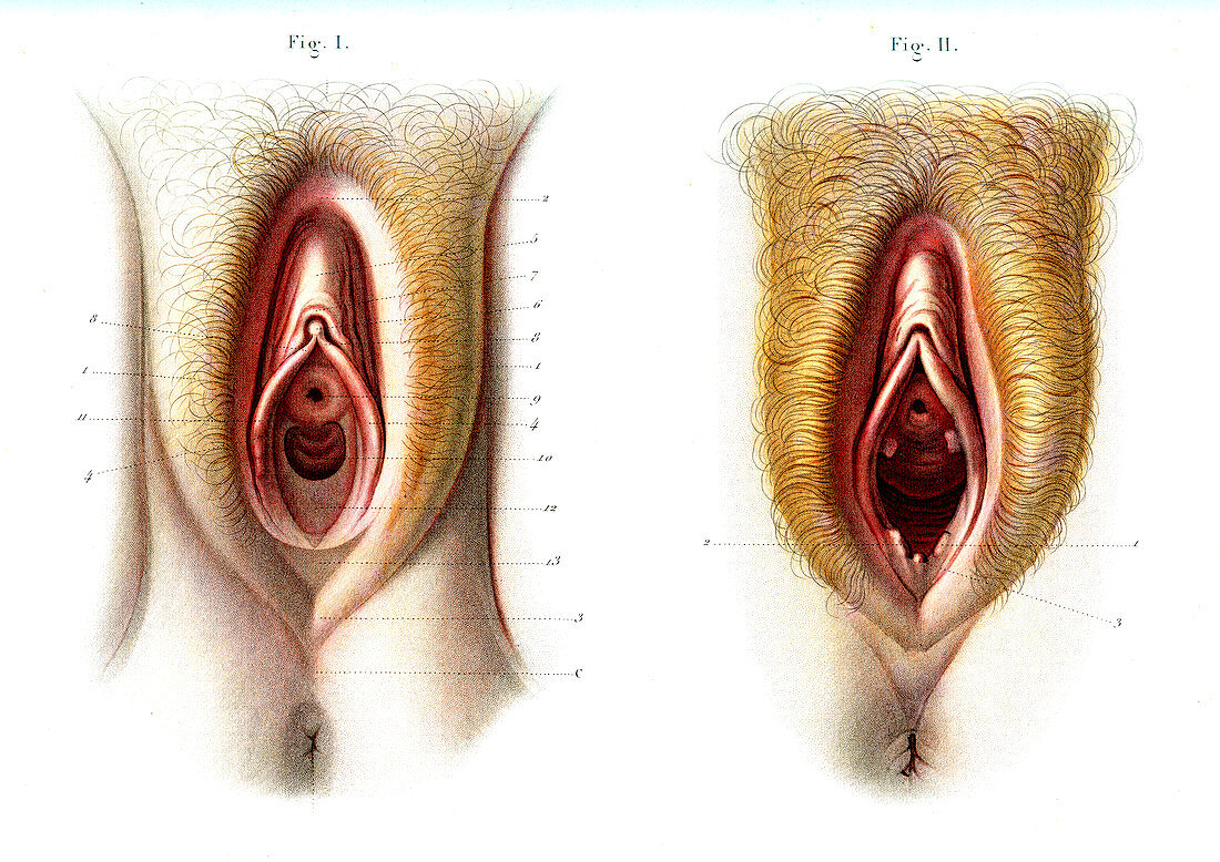 Virgin and non-virgin vulva anatomy