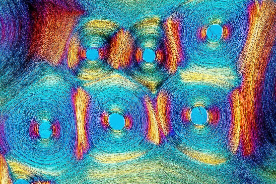 Whalebone,polarised light microscopy