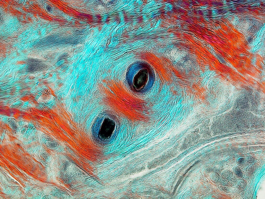 Human scalp,polarised light microscopy