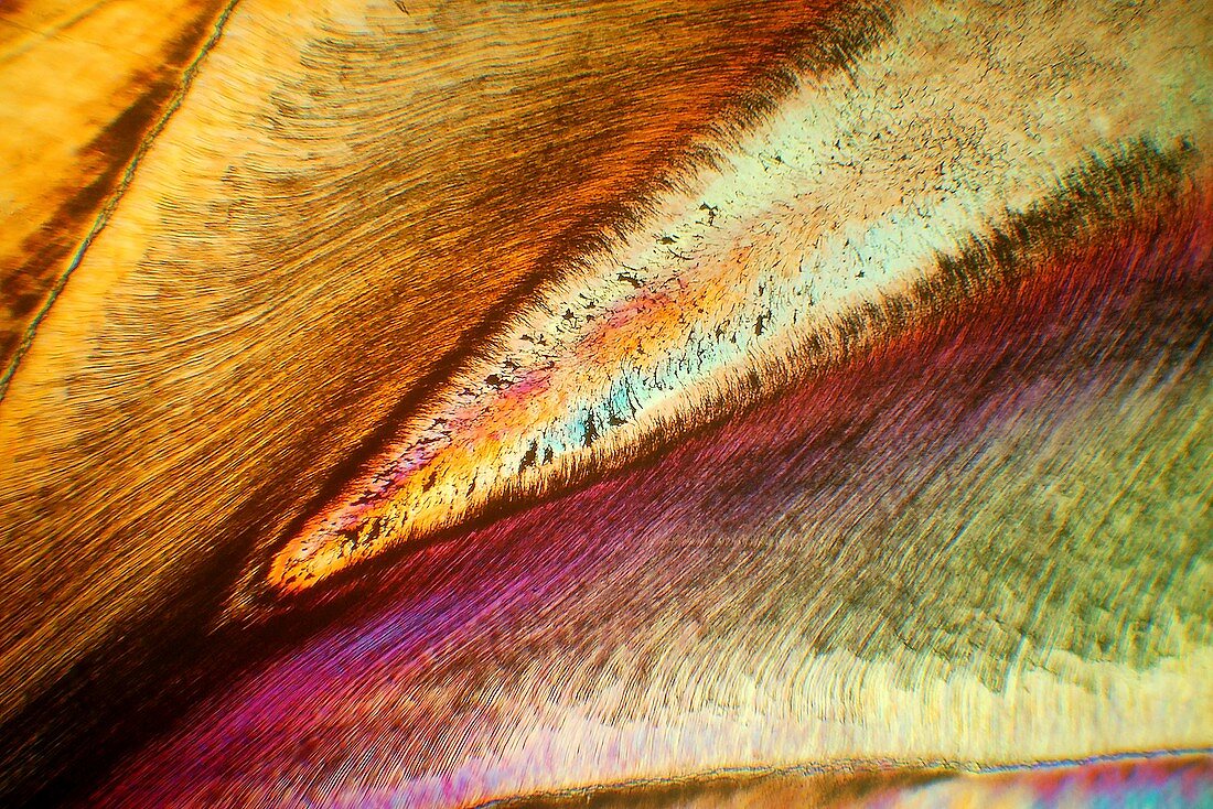 Human tooth,polarised light microscopy