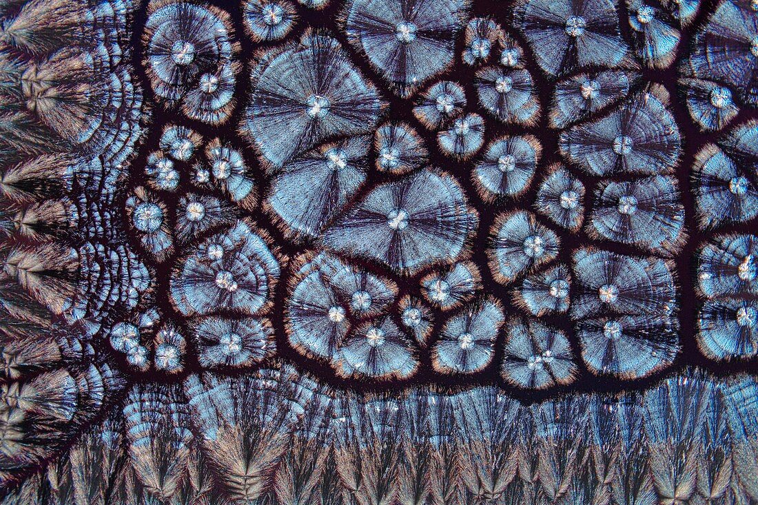 Cholesterol crystals,light micrograph