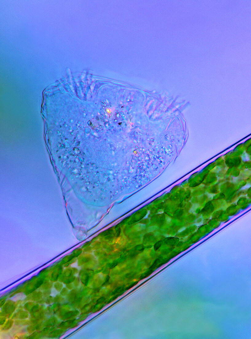 Protozoan on green algae,micrograph