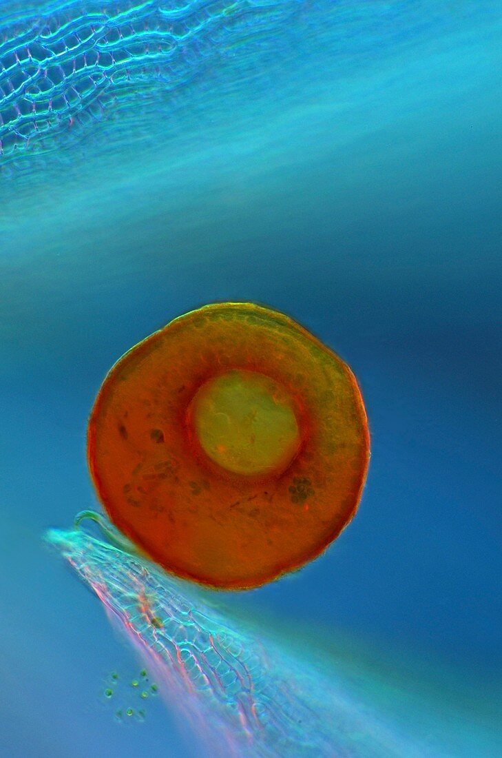 Shelled amoeba and sphagnum moss