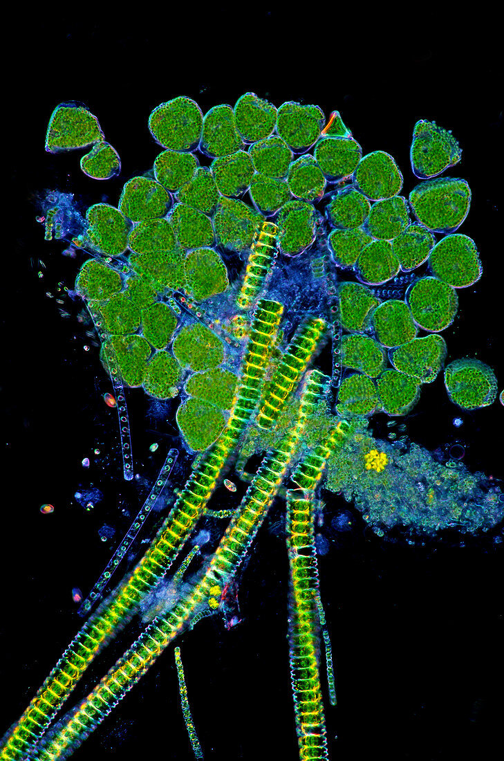 Protozoa and desmids,light micrograph