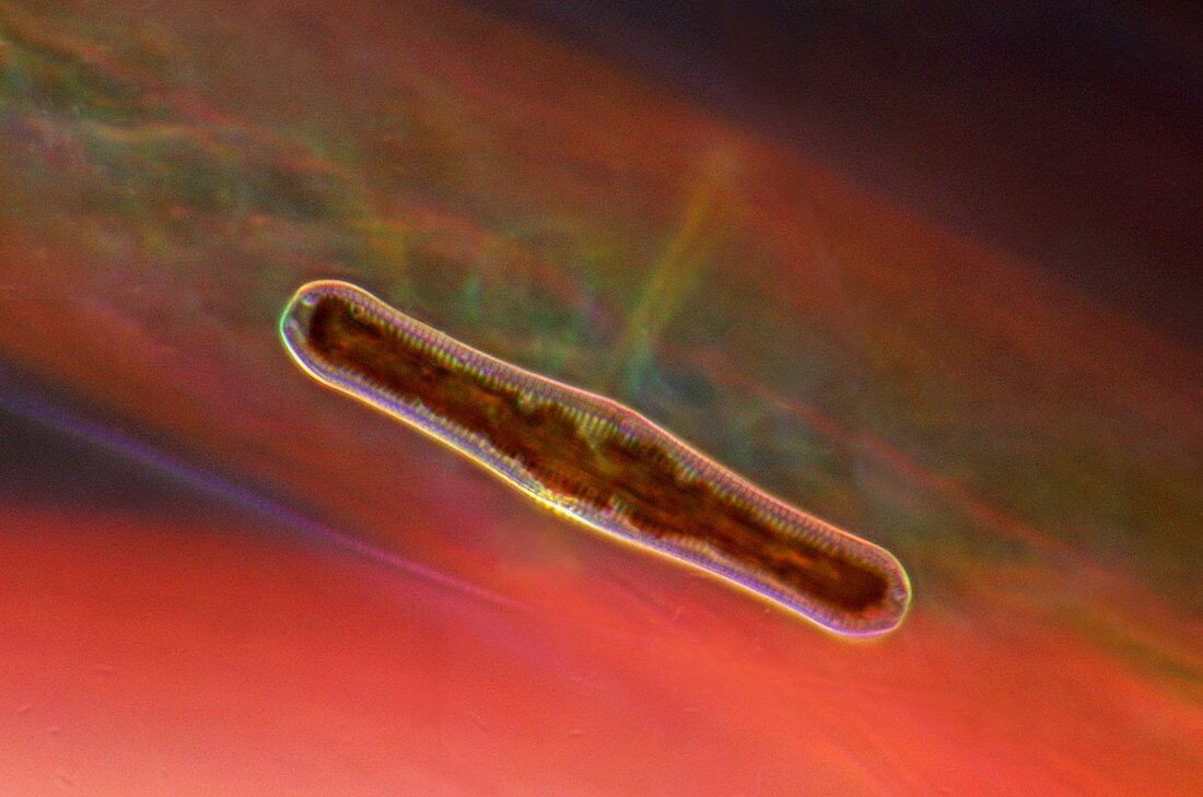 Diatom,light micrograph