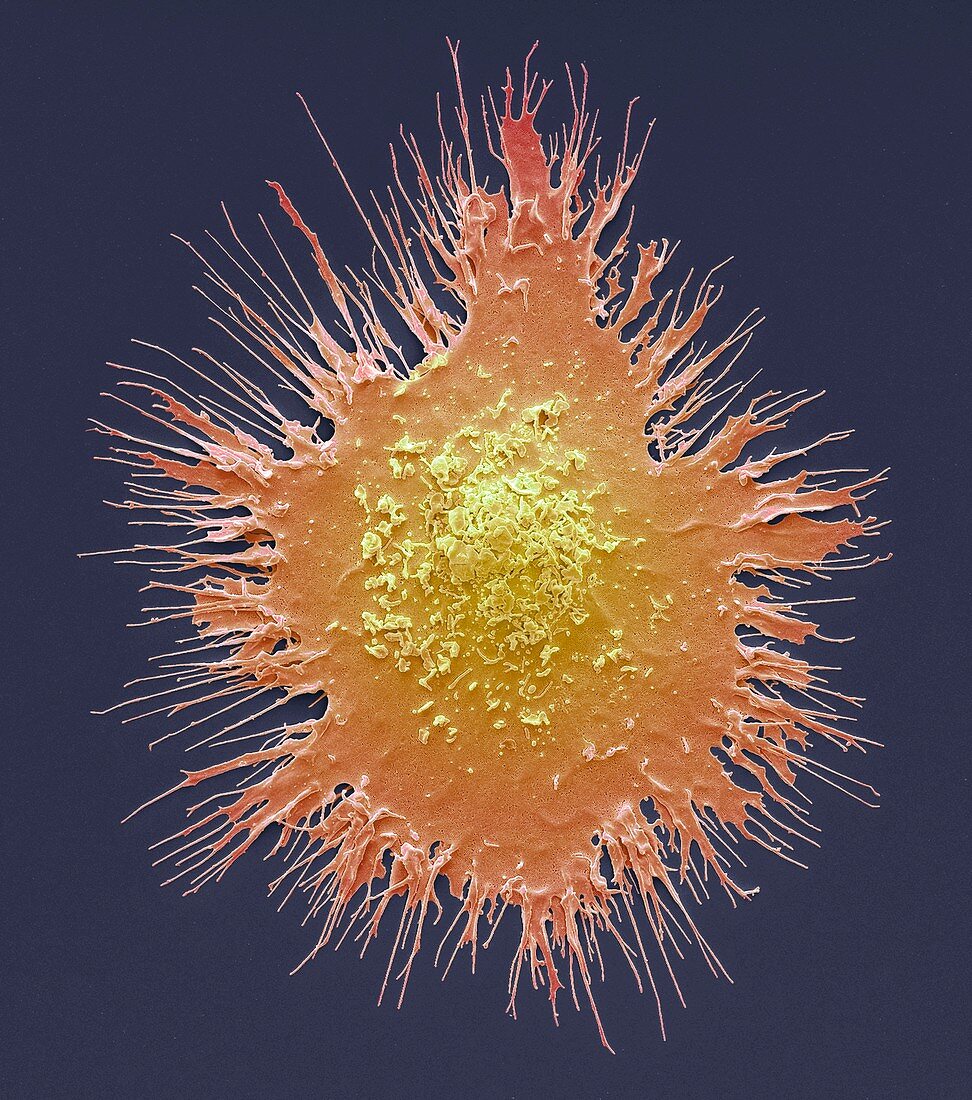 Dendritic cell,SEM