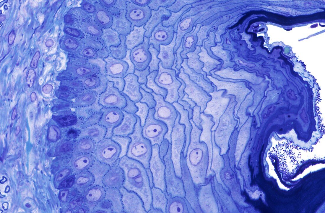 Stratified epithelium,light micrograph